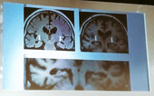 Human brain